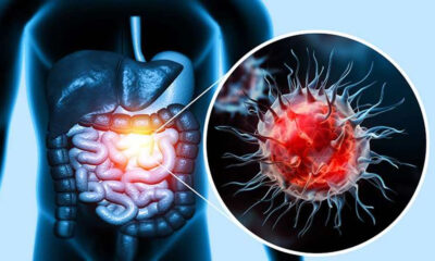 Anvisa autoriza pesquisa com Car-T Cell contra o câncer